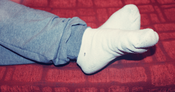 Should I Wear Socks to Bed with Athlete's Foot?